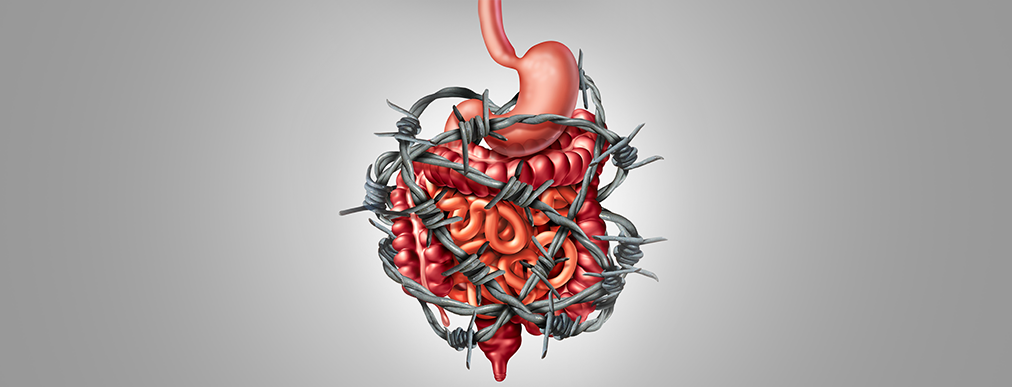 Fiber: Beneficial or Problematic for constipation